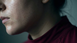 Close-up of freshly cleansed, blemish-prone skin with a dewy finish