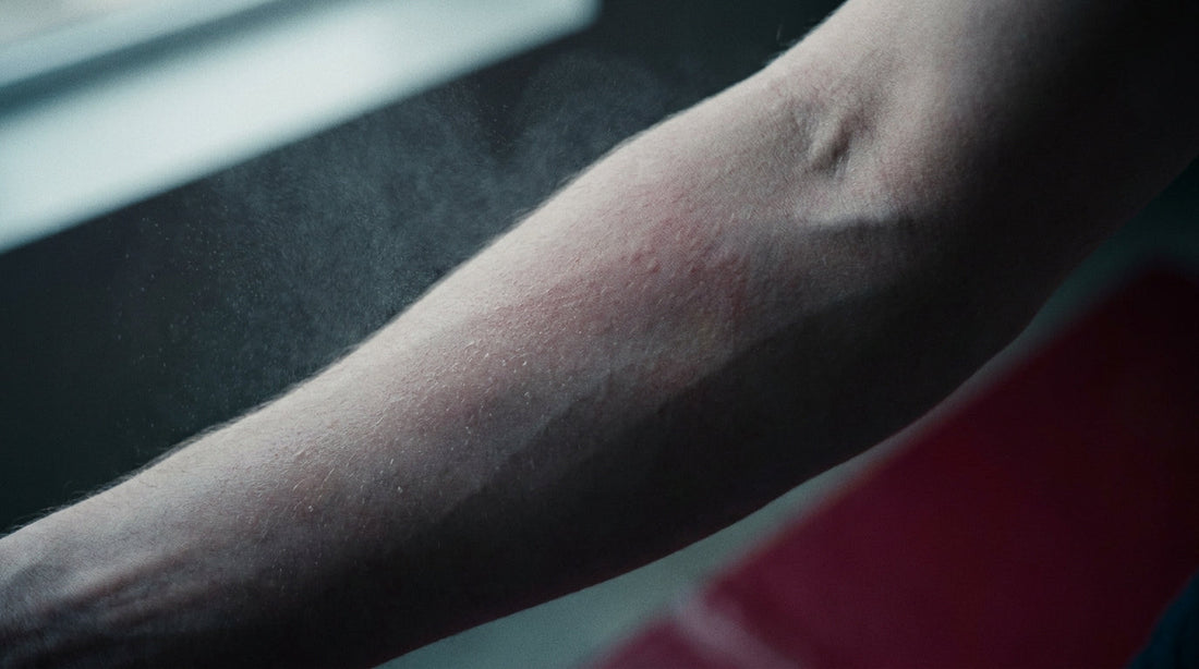 Close-up of friction-stressed forearm skin being soothed with a fine mist