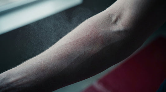 Close-up of friction-stressed forearm skin being soothed with a fine mist